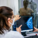 Medical personnel use a mammogram to examine a woman's breast for breast cancer.